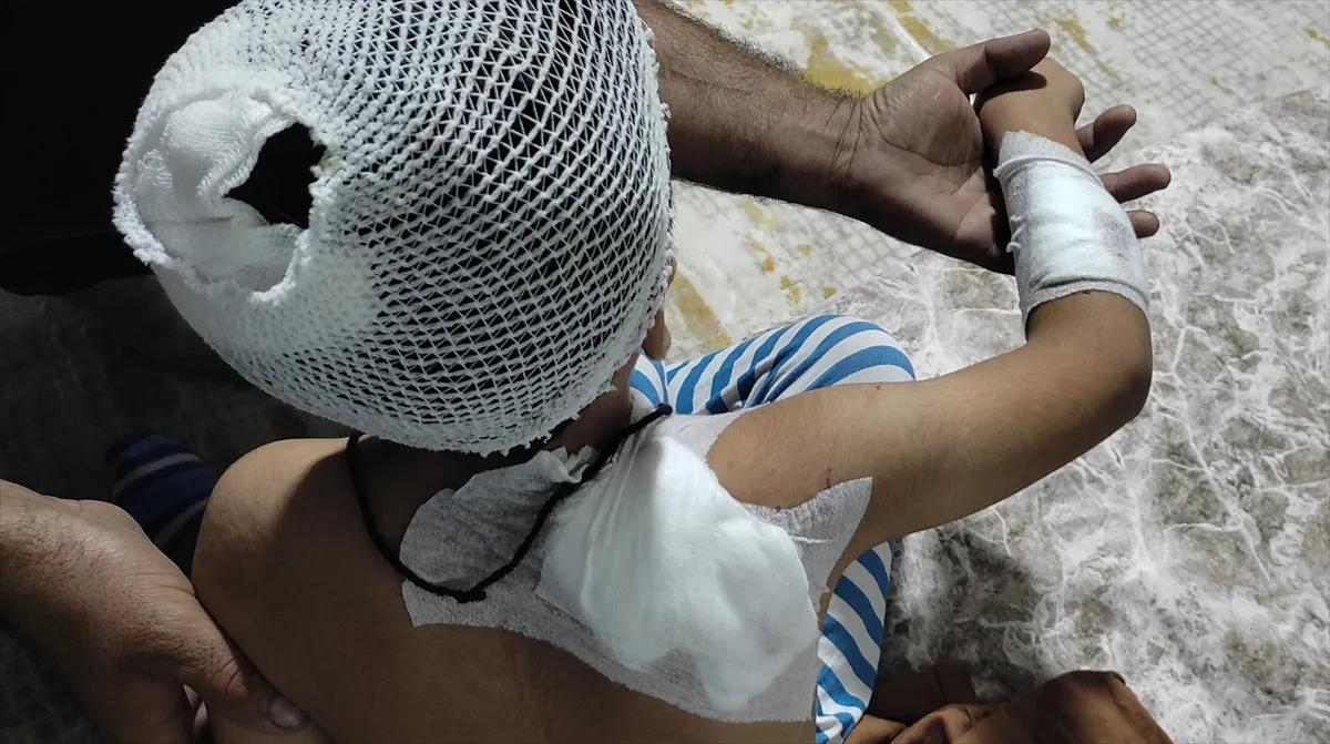 Şanlıurfa’da sahipsiz köpeklerin saldırısına uğrayan çocuk yaralandı