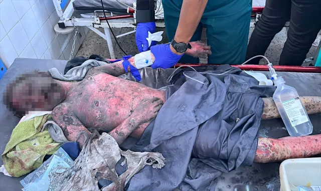 İsrail ordusunun Gazze kentine düzenlediği iki saldırıda 42 kişi öldü İsrail ordusunun Gazze kentine düzenlediği iki saldırıda 42 kişi öldü
