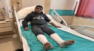 Beton harcının bacaklarında yanıklar oluşturduğu işçinin tedavisi Erzurum'da sürüyor