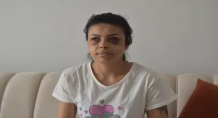 GÜNCELLEME - Kırklareli'nde bir kadın, düğündeki kavgada tüfekten çıkan saçmalarla gözünden yaralandı