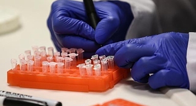 Erken tanı lenfomada tedavi başarısını artırıyor