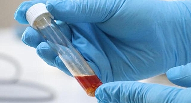 Uyuşturucu soruşturmasında 3 şüphelinin testi pozitif çıktı