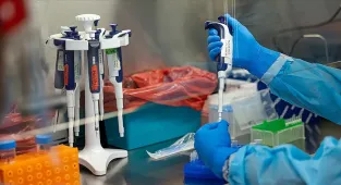 Gana'da M çiçeği vaka sayısı 1062'ye yükseldi