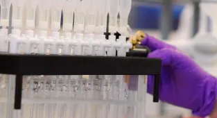 Yapay zeka geniş veri imkanıyla kanser teşhisine katkı sunuyor